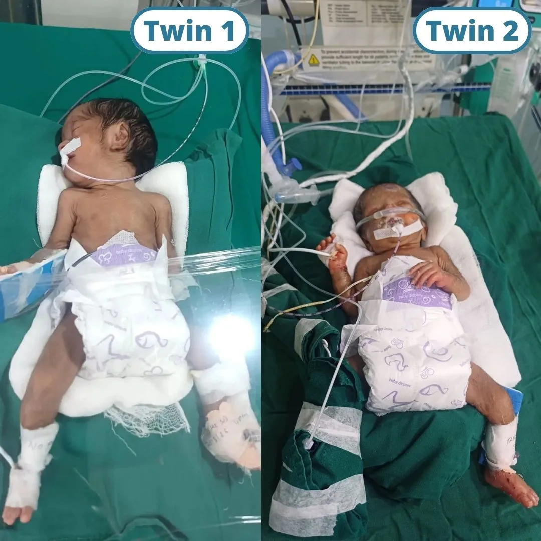 Save Twin BO Akanksha