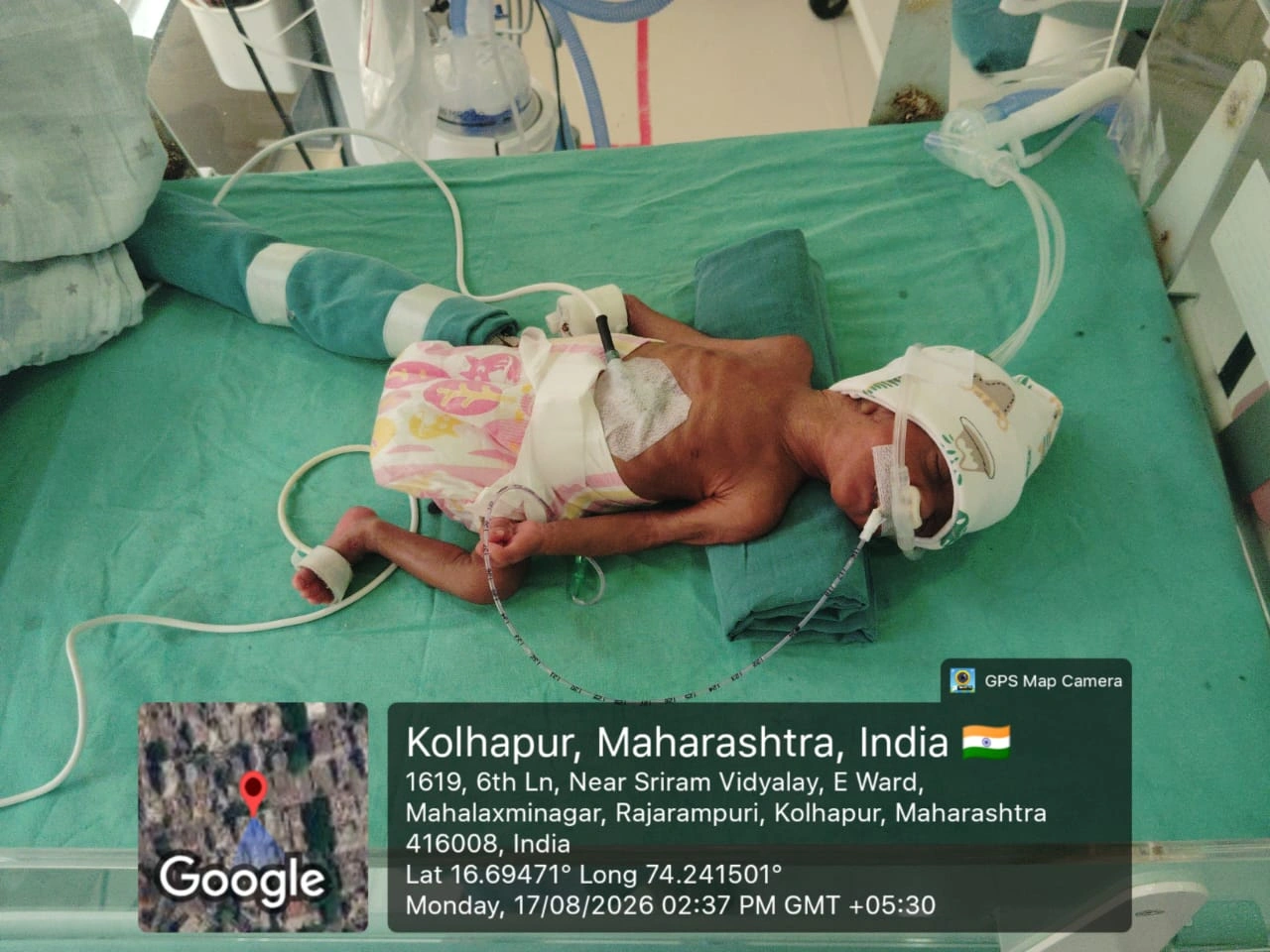 Baby Of Kishori (Twin1)
