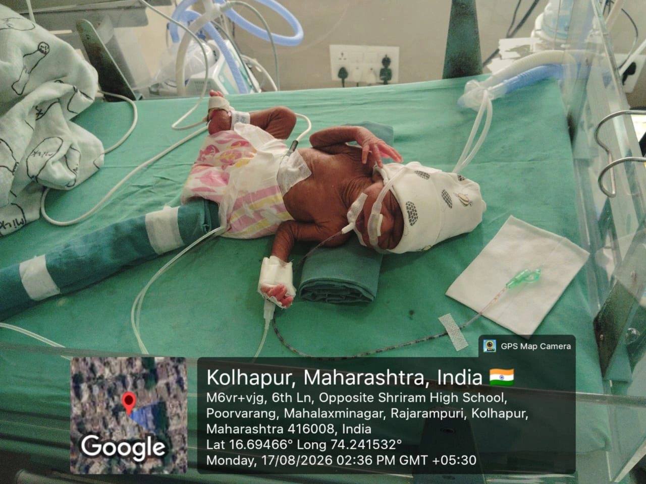 Baby Of Kishori (Twin2)
